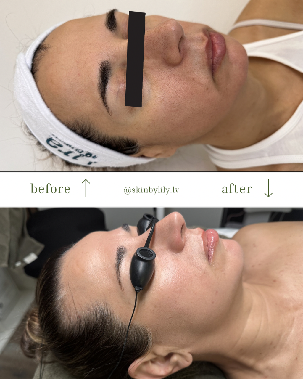 Texture Transformation